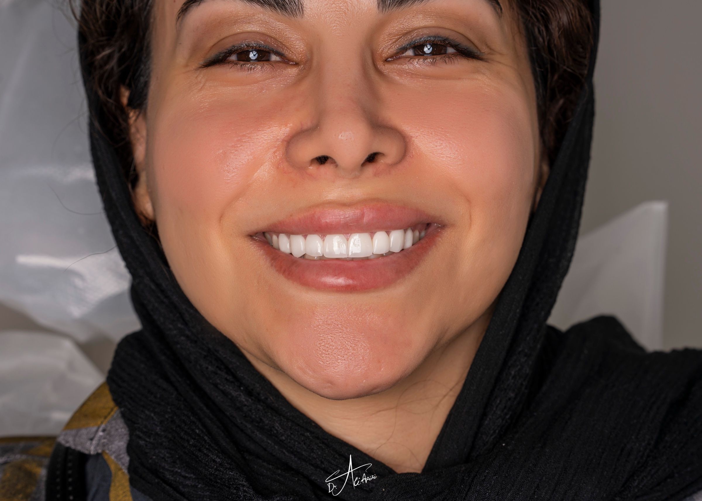 بازسازی لبخند