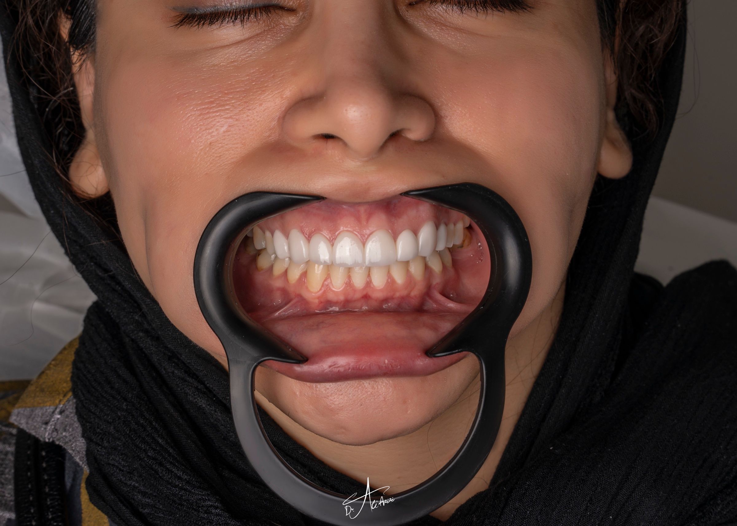 بازسازی لبخند — عکس 2