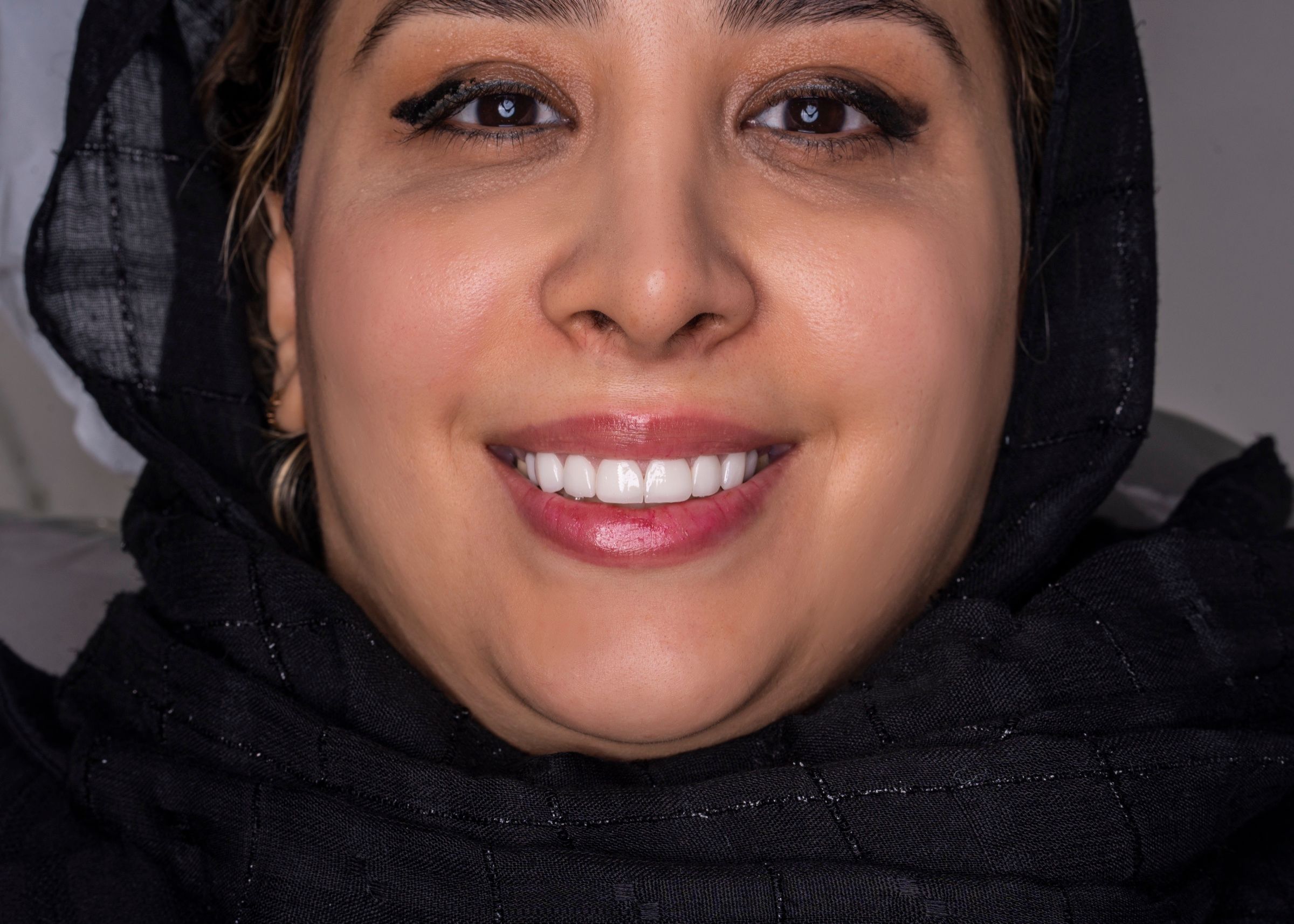طراحی لبخند